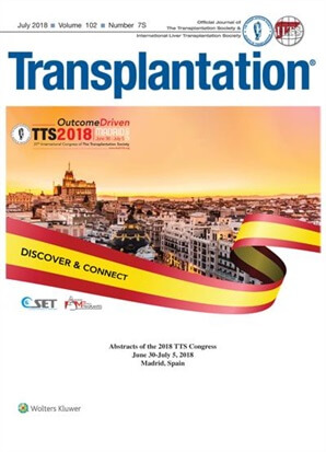Science Journal: Transplantation